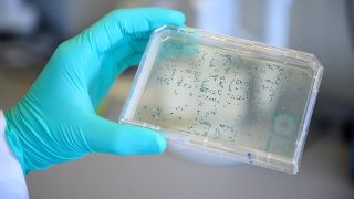 Jemand schaut sich in einem Labor einen Träger mit Bakterien an (Bild: dpa)