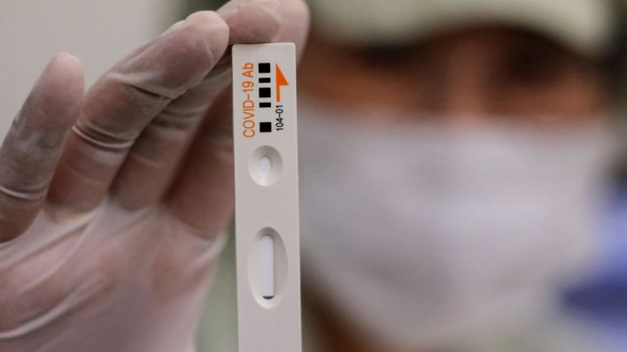 Ein Mitarbeiter eines Pharmaunternehmens hält ein Teströhrchen für einen Covid-19-Antikörpertest in der Hand