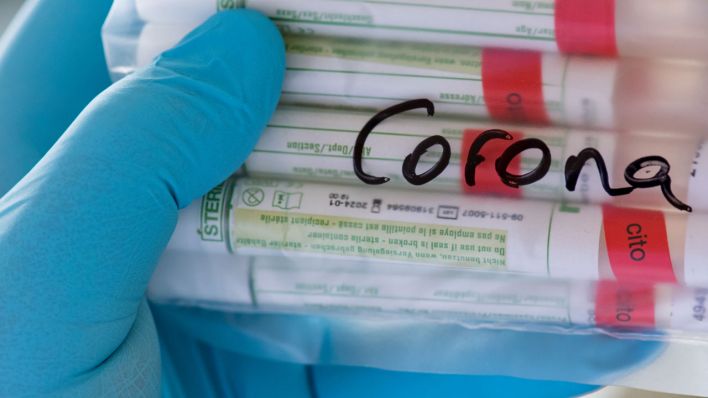 Proben für Corona-Tests im Labor (Bild: dpa/ Hendrik Schmidt)