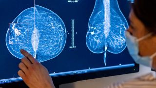 Mammografie, Untersuchung auf Brustkrebs (Bild: picture alliance/dpa)