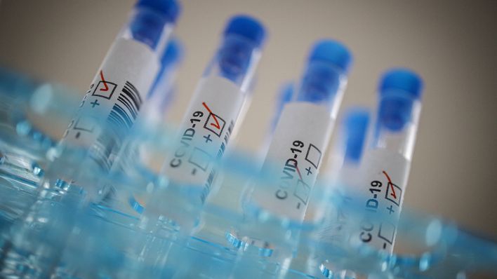 Symbolbild: Mehrere Testtuben für einen Coronavirustest (Bild: imago images)