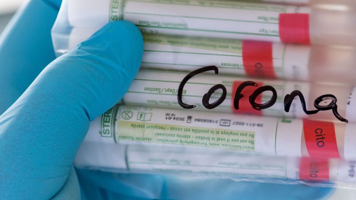 Proben für Corona-Tests werden iin einem Labor für die weitere Untersuchung vorbereitet (Quelle: dpa/Hendrik Schmidt)