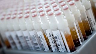 Symbolbild: Blutentnahmeröhrchen mit Blutproben für einen Corona-Antikörper-Test stehen in einem Rack. (Quelle: dpa/Marijan Murat)