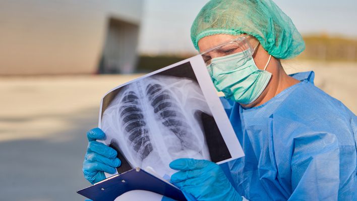 Radiologin studiert Röntgenbild von Lunge eines Covid-19 Patienten mit Lungenentzündung (Quelle: dpa/Robert Kneschke)