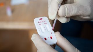 Ein Mann gibt mit einer Pipette Blut auf einen Schnelltest auf Antikoerper des SARS-CoV-2 Virus. (Quelle: dpa/Daniel Reinhardt)