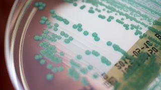 Eine Petrischale mit MRSA-Keimen (Methicillin-resistenten Staphylococcus aureus), aufgenommen am 10.04.2017 im Universitätsklinikum Regensburg (Bayern). (Quelle: dpa/Armin Weigel)