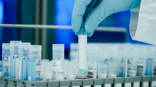 Ein Mitarbeiter hält in einem Coronatest-Labor der Limbach Gruppe PCR-Teströhrchen in den Händen. (Quelle: Uwe Anspach/dpa)
