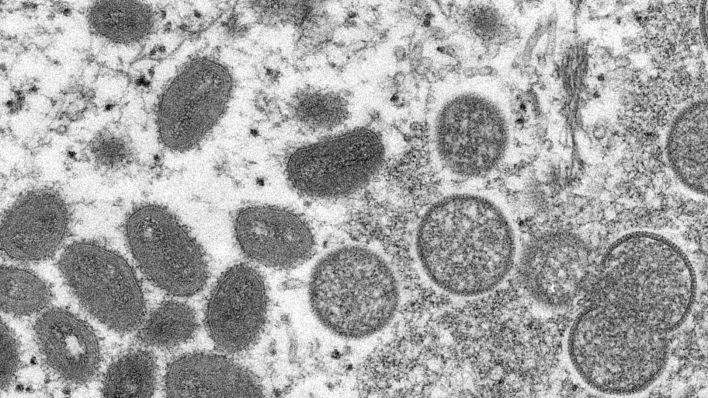 Eine elektronenmikroskopische Aufnahme aus dem Jahr 2003 zeigt Affenpockenviren (Quelle: Russell Regner/CDC/AP/Cynthia S. Goldsmith)
