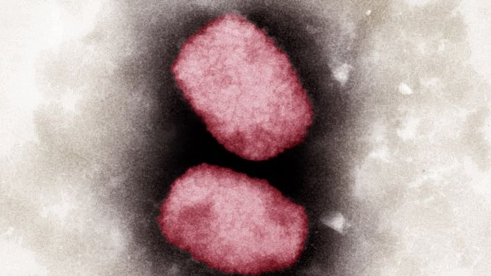 Elektronenmikroskopische Aufnahme von Affenpocken-Viren, koloriert. (Quelle: dpa/Andrea Männel)