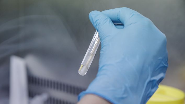 Eine Krankenschwester führt einen PCR-Test zur Erkennung von Affenpockenviren durch (Quelle: Europa Press/Carols Luján)