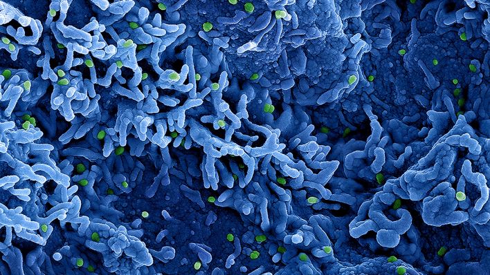 Archivbild: Eine kolorierte rasterelektronenmikroskopische Aufnahme des Affenpockenvirus (grün) auf der Oberfläche von infizierten VERO E6-Zellen (blau), aufgenommen in der NIAID Integrated Research Facility, veröffentlicht am 26. Juli 2022 in Fort Detrick, Maryland. (Quelle: dpa/Press Wire)
