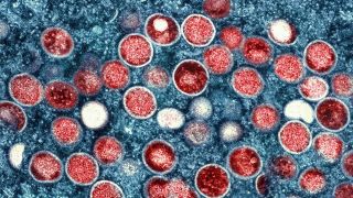 Symbolbild: Eine kolorierte transmissionselektronenmikroskopische Aufnahme von Partikeln des Affenpockenvirus (rot) in einer infizierten Zelle (blau), die im Labor gezüchtet und in der NIAID Integrated Research Facility aufgenommen wurde. (Quelle: dpa/Zuma)