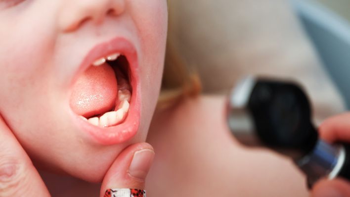 Symbolbild:Ein Kind wird von einer Kinderärztin mit einem Otoskop im Mund untersucht.(Quelle:dpa/C.Charisius)