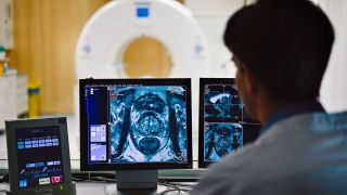 Ein Mitarbeiter betrachtet in einem Kontrollraum des Deutschen Krebsforschungszentrum (DKFZ) auf einem Monitor das Querschnittsbild einer Prostata. (Quelle: dpa/Uwe Anspach)