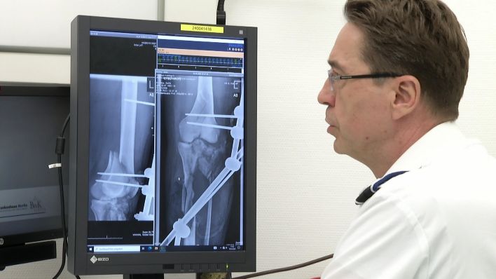 Oberstarzt Christian Willy blickt auf Röntgenaufnahmen eines zersplitterten Schienbeins im Berliner Bundeswehrkrankenhaus (Quelle: rbb)
