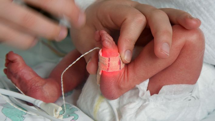 Symbolbild:Im Perinatalzentrum vom Universitätsklinikum wird ein zu klein geborenes Kind im Inkubator betreut.(Quelle:dpa-Zentralbild/W.Grubitzsch)