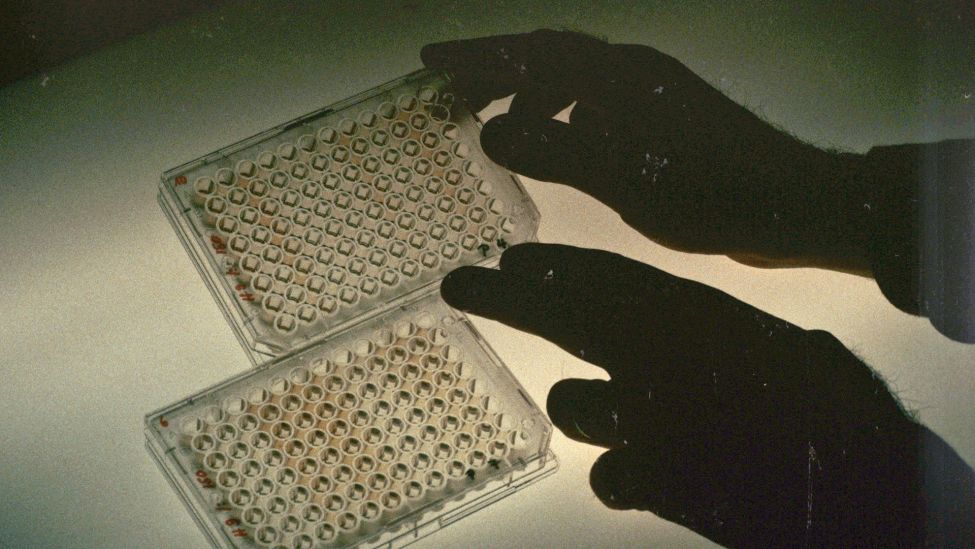 Im Bundesgesundheitsamt Berlin wird durch die Auswertung von Mikrotiterplatten eine Infizierung mit HIV-Viren festgestellt. (Aufnahme vom November 1984). (Quelle: dpa/Dieter Klar)